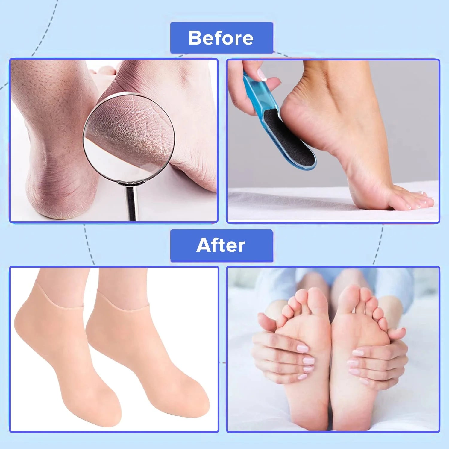 SILICONE MOISTURIZING SOCKS